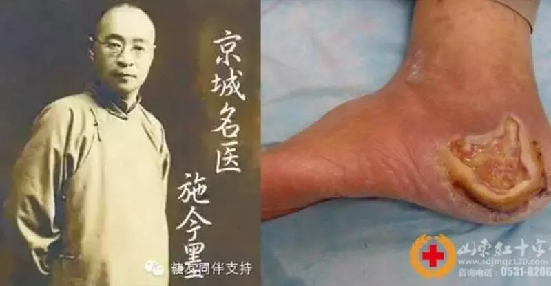中國四大名醫的糖尿病驗方,沒有一個病患是救不回來的,不想吃藥一輩子的一定要看!