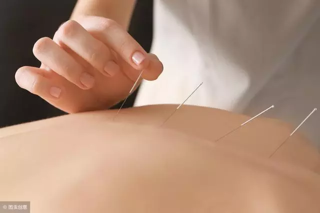 針灸和穴位的一些知道的知識希望能夠幫助到大家