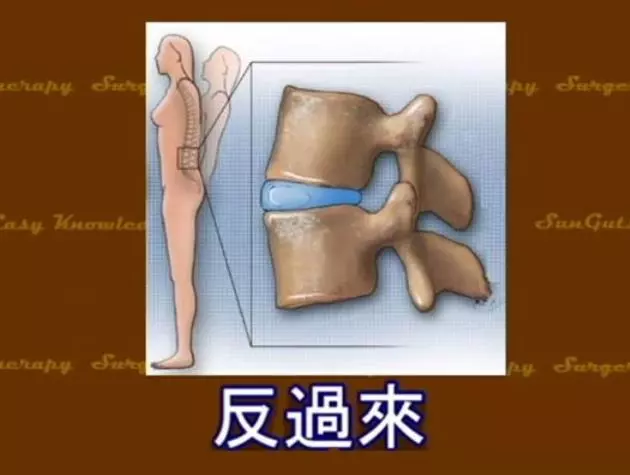 腰痛要自己救,復健師分享「私房 2 招」,改善腰酸疼痛,促進血液循環,腰椎越來越好