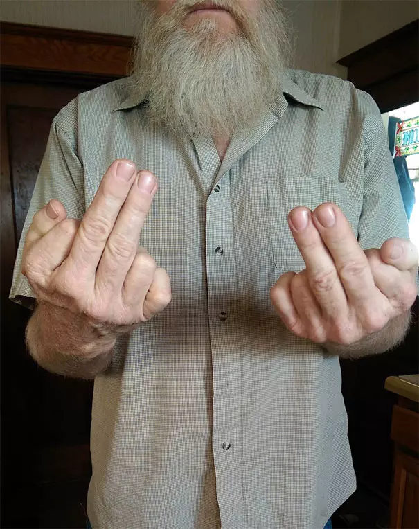 上帝的小小巧思 30個「出生就註定與眾不同」的超特別人類