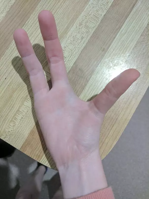 上帝的小小巧思 30個「出生就註定與眾不同」的超特別人類