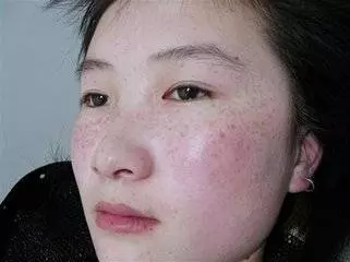 生什麼病,就忌什麼口!這張表留著很有用(珍藏級)