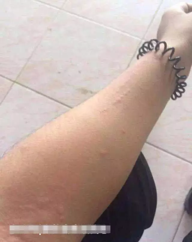 泰國女孩嫁中國小夥,新婚激戰後....第二天變「香腸嘴」,醫生的話讓他們很尷尬