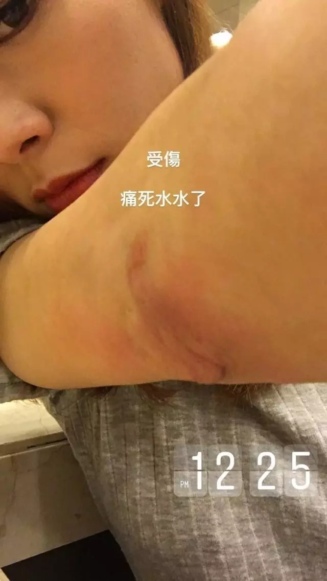 失婚又失平衡!TVB「熊若水」拍劇出意外:好在沒斷骨!