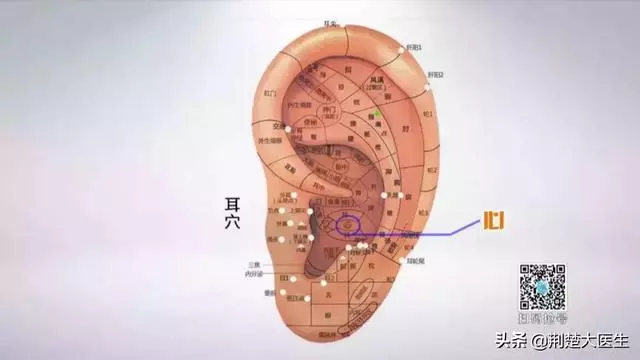 失眠別急著吃藥!常按4個穴位,常吃3種食物,中醫專家教你四步調養好睡眠!