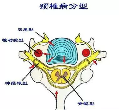 頸椎病的推拿治療一定要記住這幾個穴位