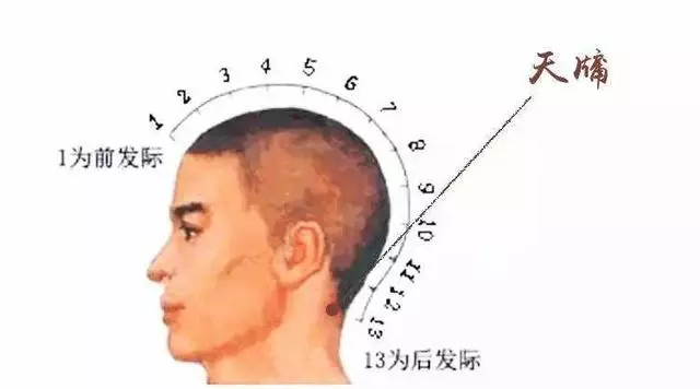 頸椎病的推拿治療一定要記住這幾個穴位