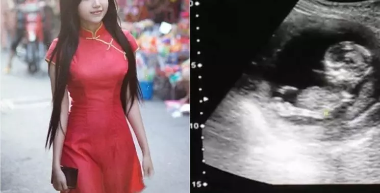 剛結婚1個月陪越南嬌妻看婦產科!被恭喜「懷孕6周」老公當場聽傻..