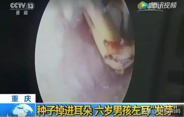 5歲男童遊樂場離世,遊樂場裡這些危險的角落,千萬別帶孩子去