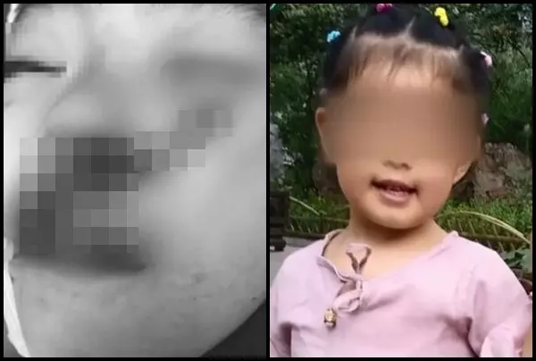 6歲女童獨自玩耍 臉慘遭怪女子猛砍5刀