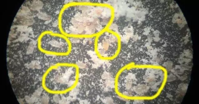 床上的蟎蟲,沒太陽曬怎麼辦?教你一招,不用曬就能消滅蟎蟲,方法簡單還省錢!!