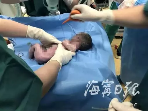 忍痛棄救早產兒…父絕望見最後一面 淚喊一句話竟出現奇蹟