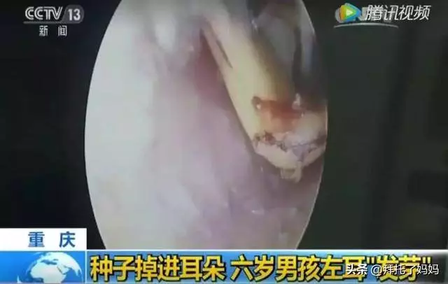 5歲男童遊樂場離世,遊樂場裡這些危險的角落,千萬別帶孩子去