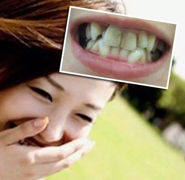 私人vs政府 · 誰更好?大馬美女分享了她在「政府醫院」綁牙的過程 原來政府和私人的待遇是那麼大差別的啊?