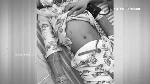 疑遭虐死亡…11歲女童身體不明色塊 生母喊冤:那是胎記 【內附視頻】