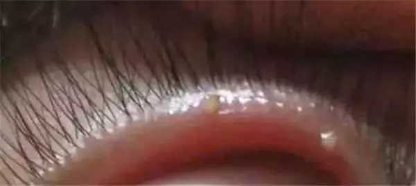 鏡子是半個醫生,照出身上有「這個」千萬別猶豫,馬上去醫院就對了! -