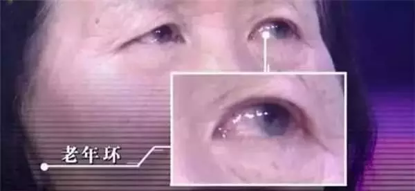 鏡子是半個醫生,照出身上有「這個」千萬別猶豫,馬上去醫院就對了! -