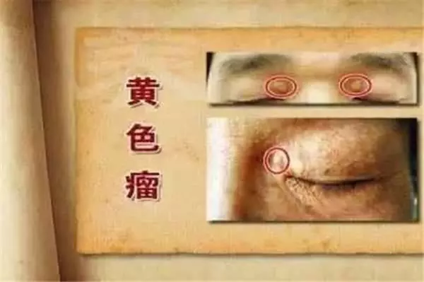 鏡子是半個醫生,照出身上有「這個」千萬別猶豫,馬上去醫院就對了! -