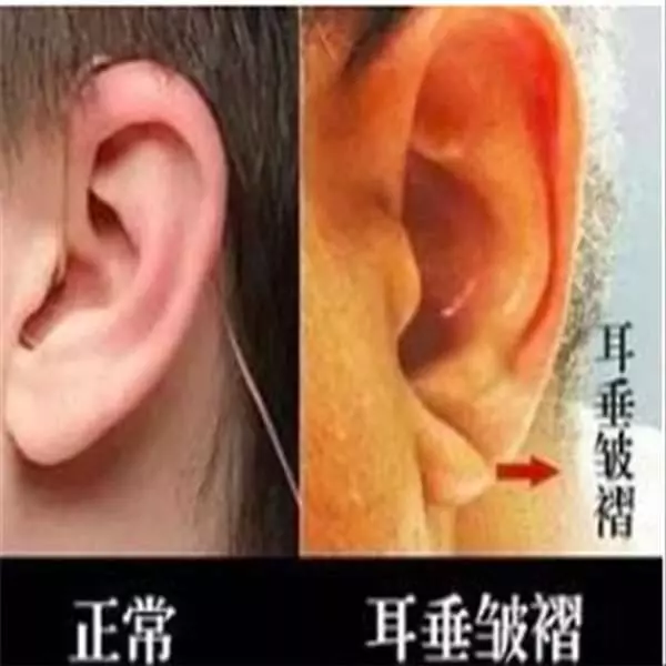 鏡子是半個醫生,照出身上有「這個」千萬別猶豫,馬上去醫院就對了! -