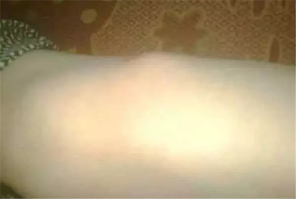 鏡子是半個醫生,照出身上有「這個」千萬別猶豫,馬上去醫院就對了! -