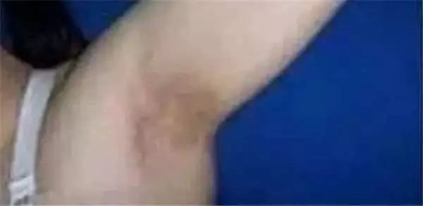鏡子是半個醫生,照出身上有「這個」千萬別猶豫,馬上去醫院就對了! -