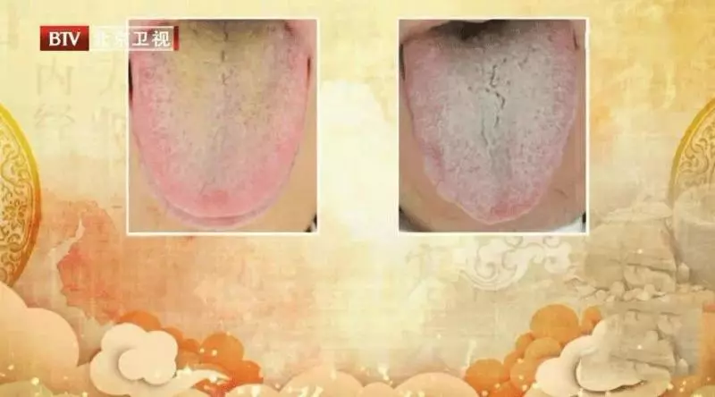 薏米祛濕又消腫?一個步驟錯了,當心濕氣越來越重!