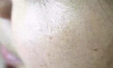 她三年沒卸過妝,在節目現場挑戰卸妝,皮膚居然長這樣,觀眾全傻了!