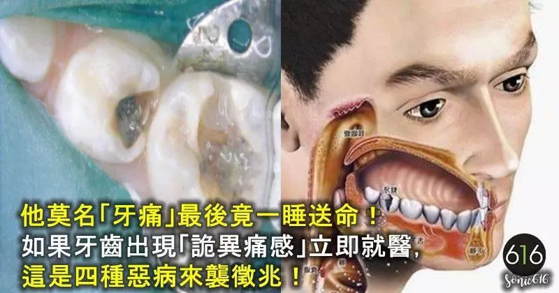 他莫名「牙痛」最後竟一睡送命!如果牙齒出現「詭異痛感」立即就醫!這是四種惡病來襲徵兆!
