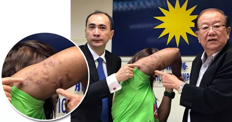 觸目驚心! 手臂瘦不成 留下千瘡百孔 | 中國報 China Press