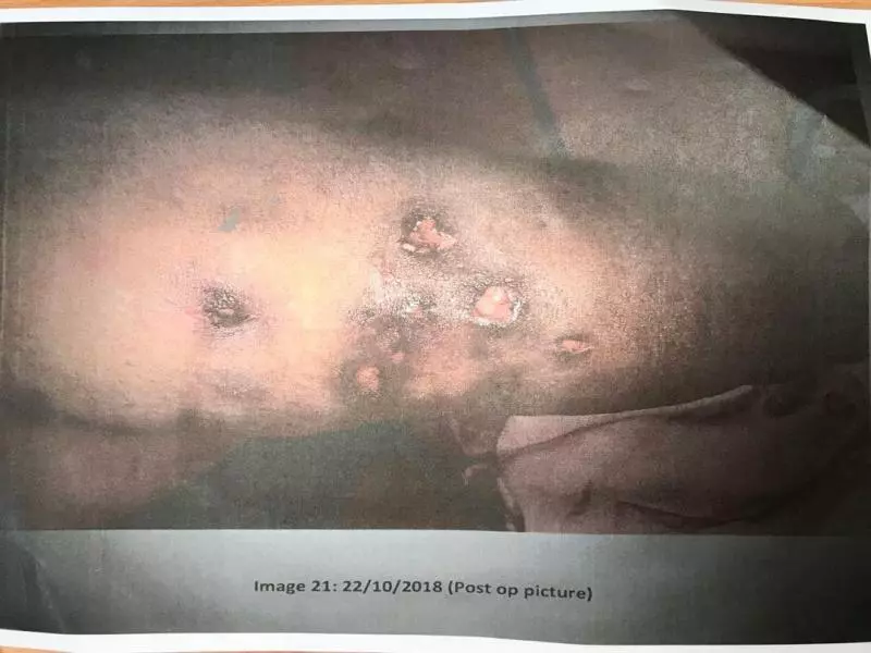 觸目驚心! 手臂瘦不成 留下千瘡百孔 | 中國報 China Press