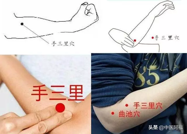手三里穴-——落枕和急性腰扭傷首選穴