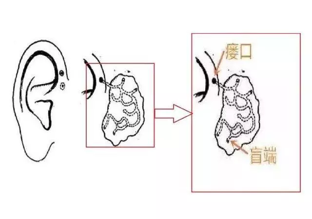 孩子生下來耳朵上就有小孔?不是福氣,爸媽要心裡有數,不容忽視