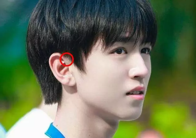 孩子生下來耳朵上就有小孔?不是福氣,爸媽要心裡有數,不容忽視
