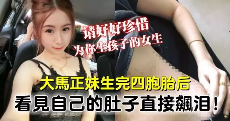【請好好珍惜為你生孩子的女生】大馬正妹生完四胞胎後 見自己的肚子直接飆淚!!