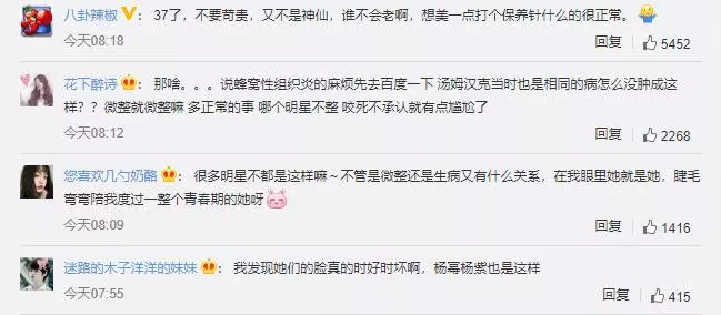 【甜心教主怎麼了?!】36歲王心凌「五官腫脹變形」,激像羅斯瑪!網友:這根本整壞了!