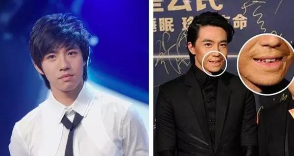 顏值回歸了!當年與Selina一起被燒傷,8年後俞灝明"燒傷臉"近照曝光!網民:依然帥氣!
