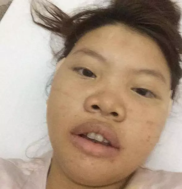 女子因太醜被嫌棄,花巨資整容嫁給富二代,網友:成為人生贏家
