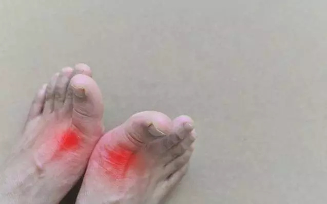 高尿酸「吃」出來,醫生提醒:6種食物不要吃,幫你遠離腎衰竭!
