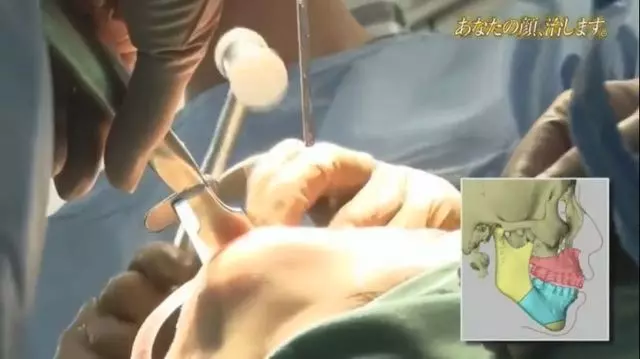 有村架純姊姊3.0版進化!整形後合照「公開處刑妹妹」變超正:這下有得比了
