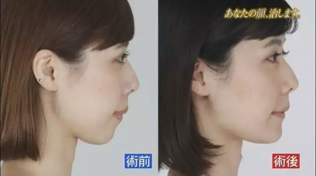 有村架純姊姊3.0版進化!整形後合照「公開處刑妹妹」變超正:這下有得比了