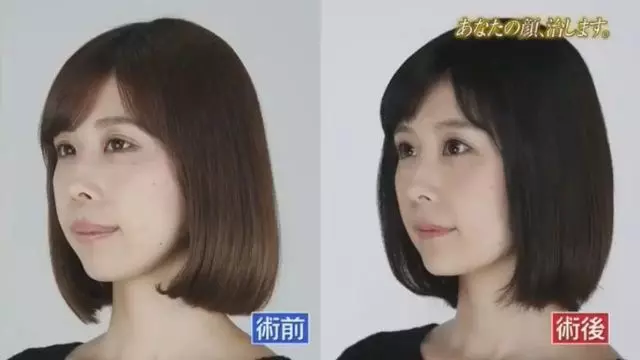有村架純姊姊3.0版進化!整形後合照「公開處刑妹妹」變超正:這下有得比了