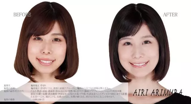 有村架純姊姊3.0版進化!整形後合照「公開處刑妹妹」變超正:這下有得比了