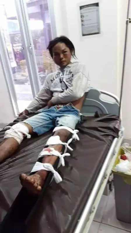 《看視頻》華人修女慘遭毒手【印尼仔被打斷腿】警方及時趕到,驅散人群!