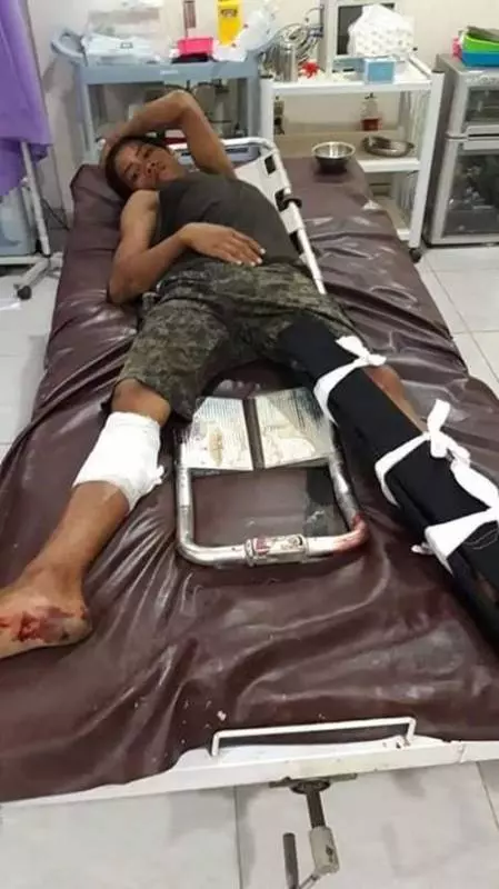《看視頻》華人修女慘遭毒手【印尼仔被打斷腿】警方及時趕到,驅散人群!