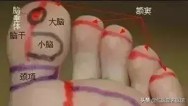 重要通知:如果腳底出現這條線,一定要揉開!!