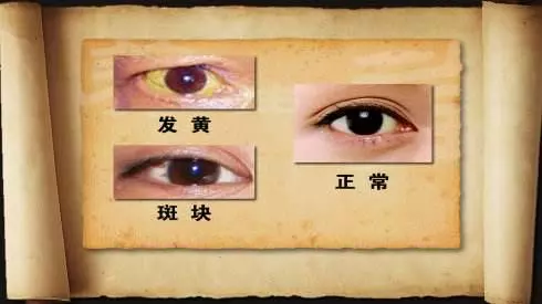 從五官就能看出身體30個健康秘密!