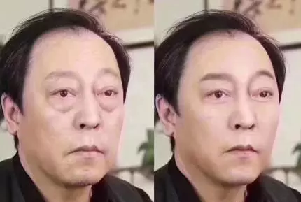 大眼袋悄悄爬上臉?多喝這1湯,消除浮腫,眼袋不足為懼!