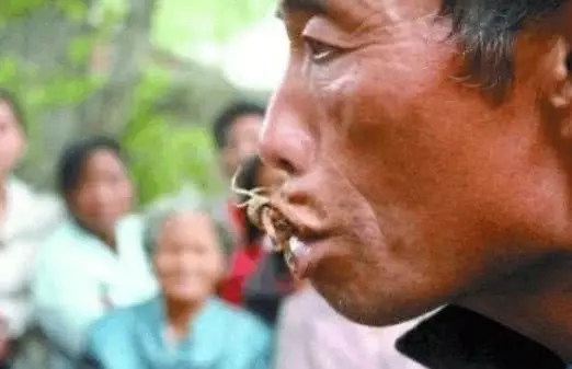 男子10年吃了一萬多隻蠍子,只為治療隱疾,醫生檢查後大呼奇蹟