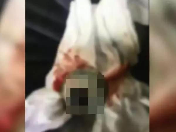 喝酒喝到斷片 酒醒後 發現左眼不見了?