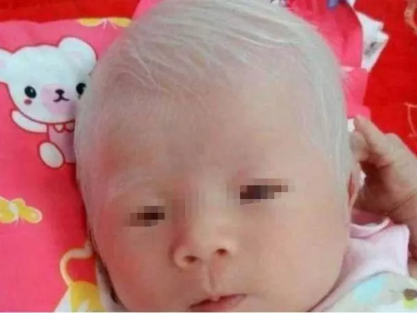 一對夫婦在垃圾堆里撿到一個白髮嬰兒,抱去醫院後,夫婦樂開了花